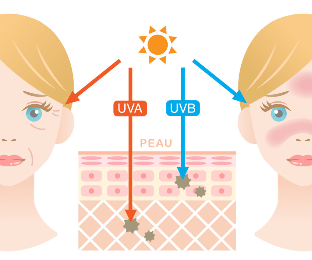 La conséquence des UV sur la peau et la santé